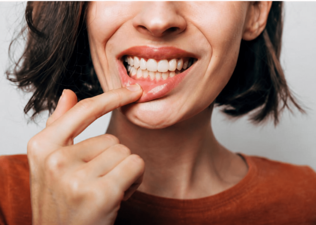 Sangrado de encías al cepillarse - clínica dental en Albacete