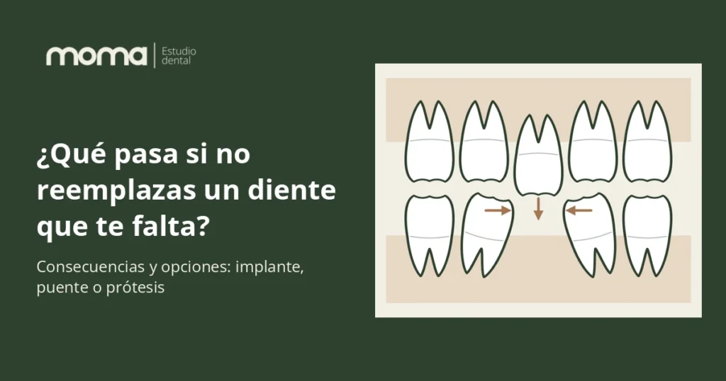 Qué pasa si no reemplazas un diente perdido, clínica dental MOMA en Albacete