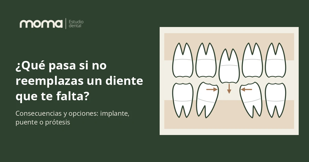 Qué pasa si no reemplazas un diente perdido, clínica dental MOMA en Albacete